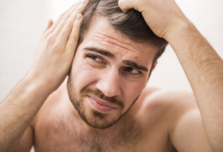 La caída de cabello afecta a hombres y mujeres (Istock)