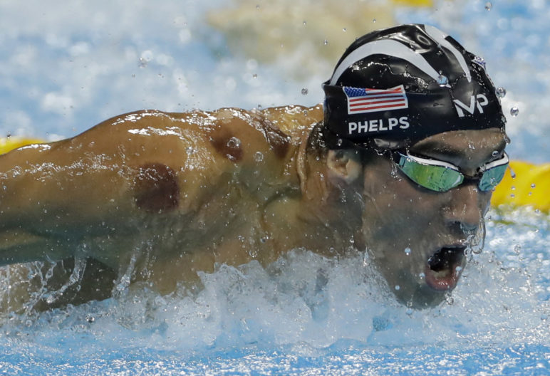 Phelps y sus ya famosos moratones (Gtres)